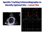 [ACC2011]TARGET：左心室植入电极导线靶向性引导心脏再同步治疗的随机对照研究